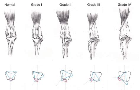 Skeletal abnormalities associated with patellar luxation. Notes: On the... | Download Scientific ...