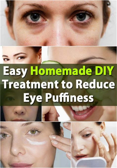 Easy Homemade DIY Treatment to Reduce Eye Puffiness - DIY & Crafts