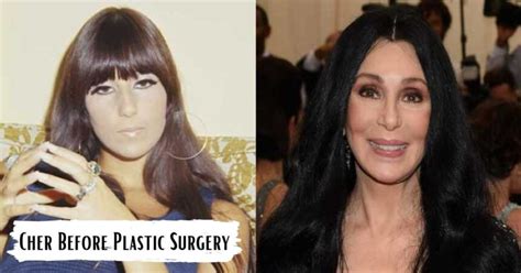 Cher Before Plastic Surgery, Flawless Face Has Changed Over Time