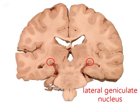 Lateral Geniculate Nucleus (LGN) – Introduction to Neuroscience