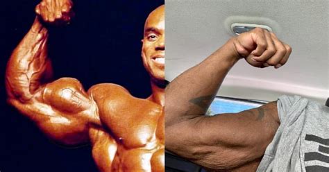 Flex Wheeler Details Heartbreaking Muscle Loss In Arm Following Leg ...