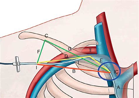 Anatomy Of Subclavian Vein | MedicineBTG.com