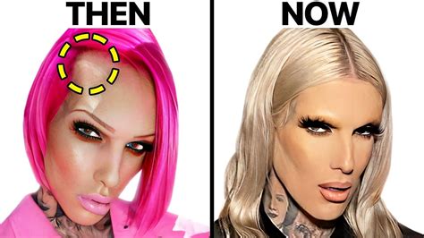 Jeffree Star Before And After