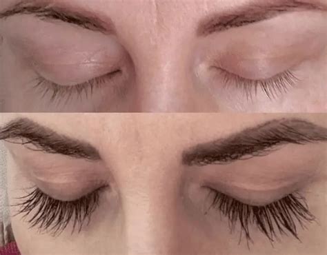 Want an Eyelash Growth Serum That Works? 7 Key Things to Look For