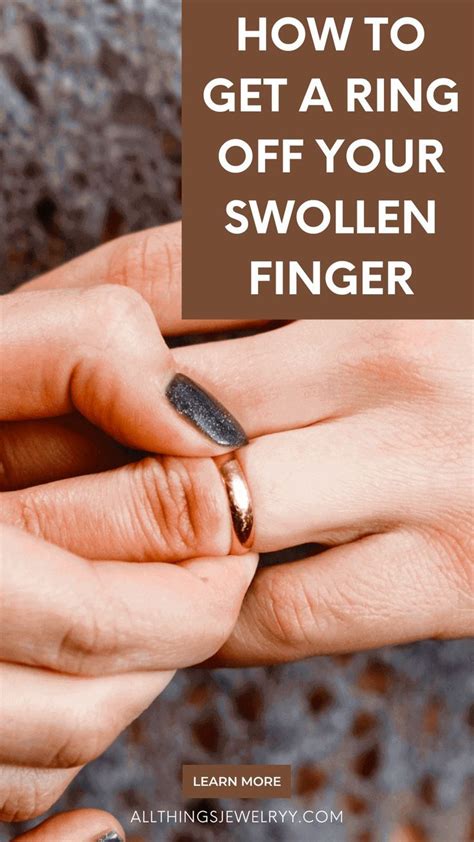 How to Remove a Stuck Ring from a Swollen Finger