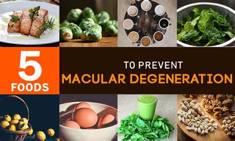 5-FOODS-TO-PREVENT-MACULAR-DEGENERATION