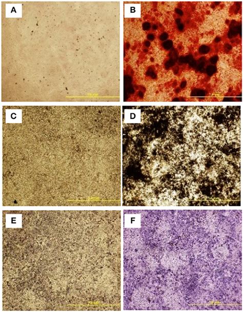 Frontiers | Isolation and Differentiation of Mesenchymal Stem Cells From Broiler Chicken Compact ...
