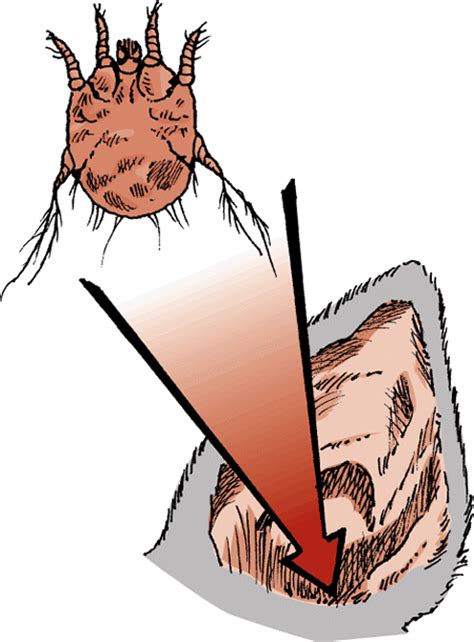 Mite Infestation (Mange, Acariasis, Scabies) of Cats - Cat Owners - MSD Veterinary Manual