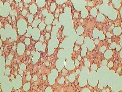 Lung Histology - Lung - histology slide