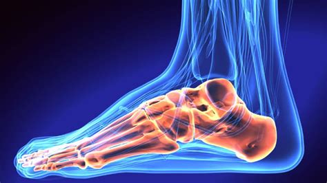 Avulsion Fracture of the Ankle: Symptoms, Causes, Treatment & Recovery