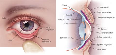 Eye Infections in Baby, Children & Adults - Causes, Diagnosis & Treatment