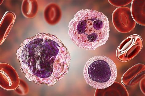 What Does High Neutrophils Low Lymphocytes Mean?