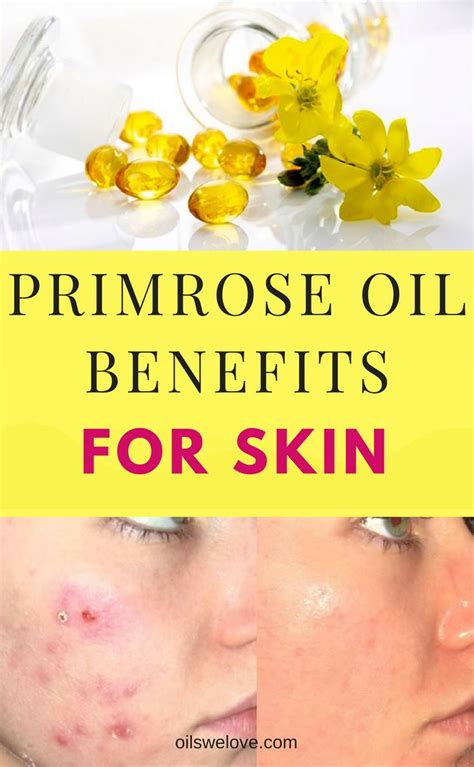 9 Phenomenal Benefits Of Evening Primrose Oil For Skin | Evening primrose oil skin, Carrier oils ...