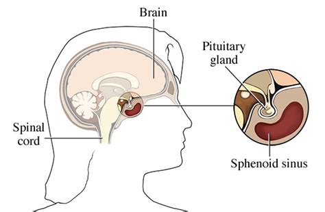 Understanding Pituitary Disorders | Brain Institute | OHSU