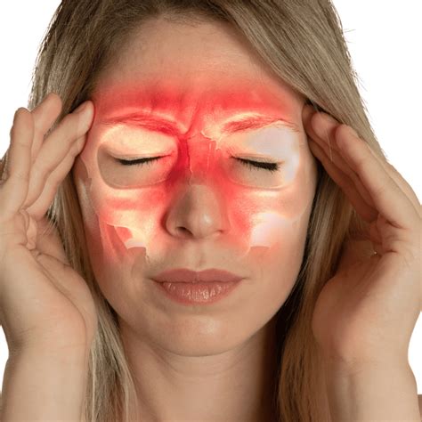 Acupuncture for Sinus Headaches: A Proven Treatment