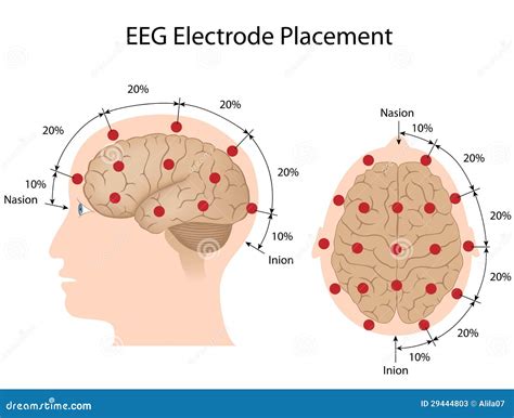 Emplacement D'électrode D'EEG Photos stock - Image: 29444803