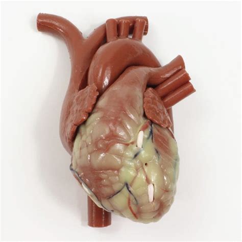 Heart model - 1339 - The Chamberlain Group - coronary arteries / muscle / body