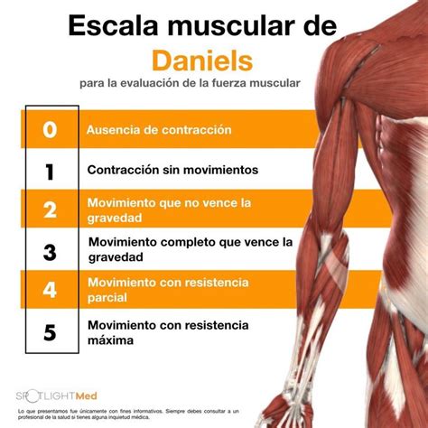 Escala muscular de Daniels:Para la evaluación de fuerza muscular. Fuente:SpotlightMed Facebook ...