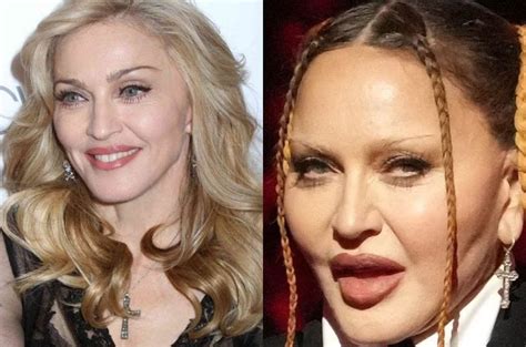 'Looks like it hurts': Madonna's 'new face' shocks fans [photos]