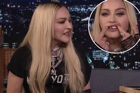 Madonna explains her grills: 'I have really ugly teeth'