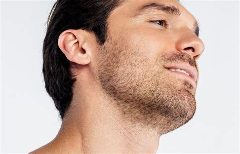 How Much Does a Beard Transplant Cost? | RealSelf