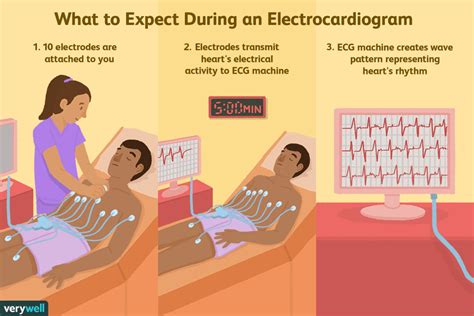 Elektrokardiogramm (EKG): Anwendung, Nebenwirkungen, Verfahren, Ergebnisse