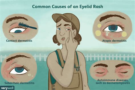 Häufige Ursachen von Lidausschlägen