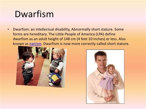 Dwarfism Symptoms