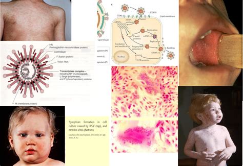 Paramyxoviruses Diagram | Quizlet