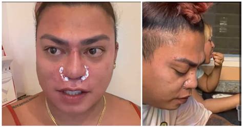 Brenda Mage, nagbahagi ng "nose reveal" video matapos niyang magpagawa ng ilong - KAMI.COM.PH