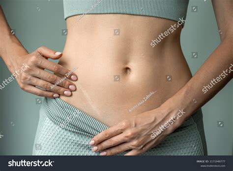 Appendectomy surgery 596 รายการ ภาพ ภาพสต็อกและเวกเตอร์ | Shutterstock