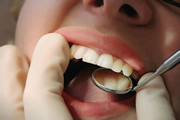 Gum Disease | Causes of Gum Disease | Cardinal Orthodontics