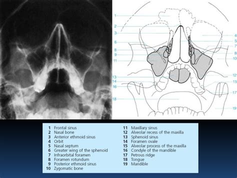 Radiographic MSK Anatomy