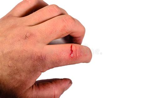 Male Hand with Bleeding Finger Isolated on White Background Stock Image ...