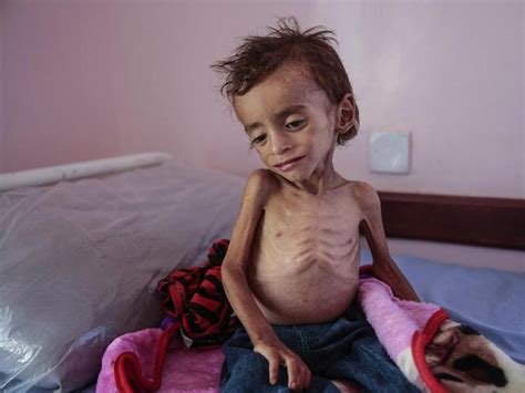 Millions of Yemenis edging closer to famine and disease, charity says ...