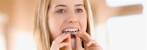 Tooth Whitening at Home - Consumer Reports