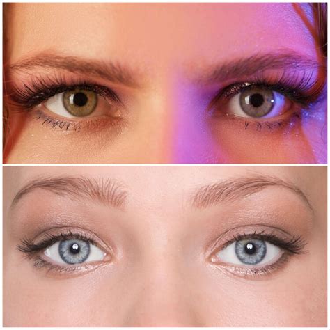 Can Botox Work Wonders On Hooded Eyes? Unveiling The Transformation