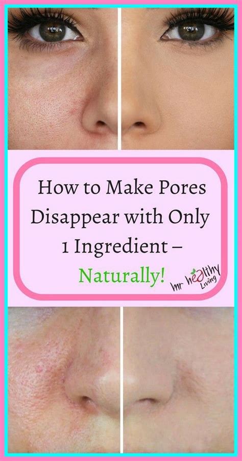 Make Open Pores Disappear With These Natural Ingredients!, Amazing ...