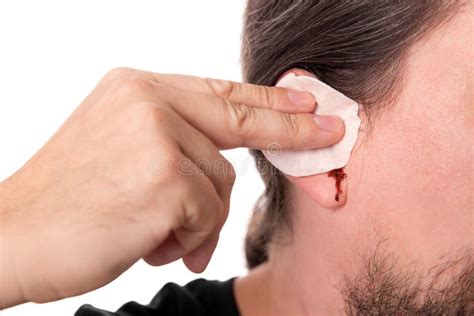 Man Having Ear Bleeding, Isolated on White, Concept Otitis Media Stock Photo - Image of ...