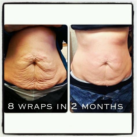 It Works! Crazy Wraps Results! 8 wraps in 2 months talk about a tummy ...