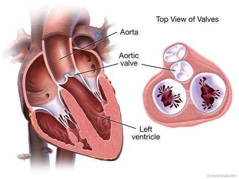 Diagram Of Aortic Valve