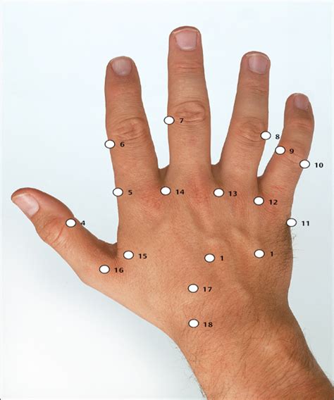 Chinese Hand Acupuncture | Musculoskeletal Key