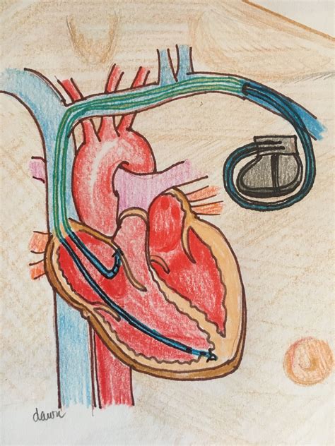 Heart Art | ECG Guru - Instructor Resources