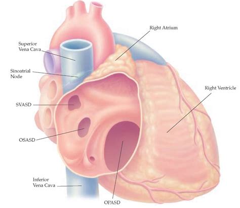 Congenital Heart Disease Part 1