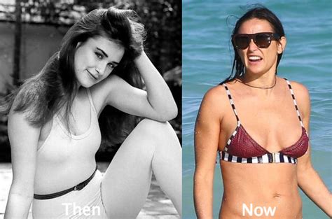 Demi Moore Plastic Surgery Before and After Photos