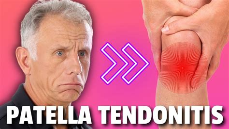 Best Treatment For Patellar Tendonitis - YouTube