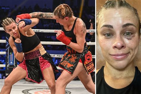 Paige VanZant shows off bruised face after brutal bare-knuckle debut ...