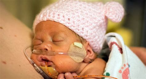 Researchers Publish Approach to High Flow Nasal Cannula in Neonates ...