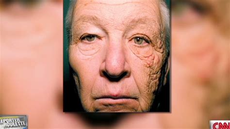 There’s proof: Sunscreen reduces skin aging | CNN