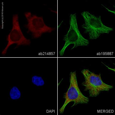 Alexa Fluor® 594 Anti-Lactate Dehydrogenase antibody [EP1566Y] (ab214857) |Abcam